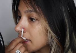 It enhances your face by alluring it with appeal, sensuality, and gorgeousness. 10 Tips To Treat An Infected Nose Piercing