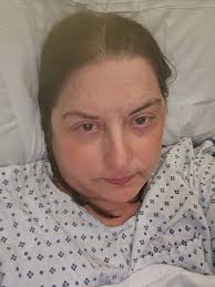 Introduction after kidney transplant