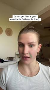 Avoid Nasolabial Folds Filler: Facial Balancing Tips