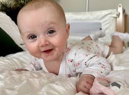 St George's surgeons' pioneering surgery saves life of baby girl born with  ultra-rare condition