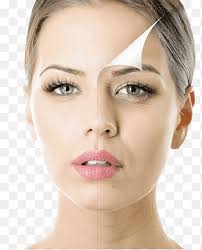 Botulinum toxin Plastic surgery Dr Genevieve Marks Dermatology, Face,  people, cosmetics png