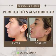 Dermaclinic Láser Uio