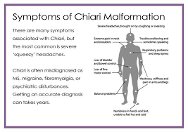 Awarness Matters Chronic Fatigue Syndrome Symptoms Chronic Fatigue Symptoms Severe Headache