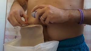 The best time to change is when your stoma is quiet. How To Change An Ostomy Appliance W Video Veganostomy