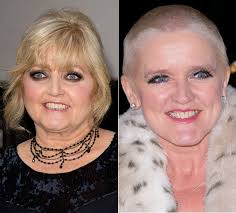 Linda nolan revealed that she had to have an emergency call with her councillor on the morning of her cancer results day, and spoke of the anxieties she was experiencing before she found out if her. Linda Nolan Says Bernie Nolan S Death Brought An End To The Sisters Rift Hello