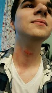 dealing with kids playing in ice storms