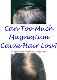 Hair Loss Best Hair Lotion For Hair Loss Burning Scalp Hair Loss Home Remedies Hair Loss Hair Loss Guava Lea Hair Loss Surgery Treat Hair Loss Hair Loss Cure