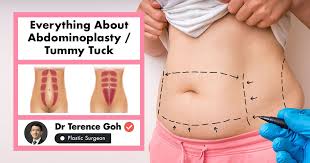 We did not find results for: Tummy Tuck Your Guide To Getting An Abdominoplasty In Singapore