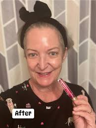 Anyone use Vitamin E oil