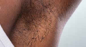 The best way to achieve optimal laser hair removal before and after images is to schedule a reputable medical spa treatment. Laser Hair Removal Before And After 01