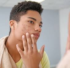 NeoSkin by Aerolase- Skin Rejuvenation in Las Vegas