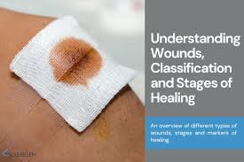 Image result for Wound Repair