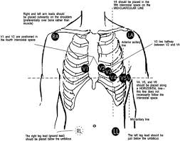 Exercise Standards For Testing And Training Circulation