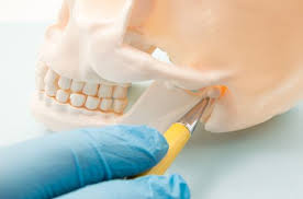 Injections of botox into the masseter, temporalis, and internal pterygoid muscles result in reduction in the oromandibular and lingual spasms and an improvement in chewing and speech. Tmj Jaw Pain Treatment In The Bronx Ny Morris Park Dental