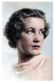 Little Edie's hair loss and recovery from childhood incident