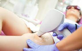 Thus, clients need multiple treatments in order to disable each batch of hair as it enters the active phase of growth. Laser Hair Removal Sharon Littzi Md