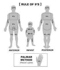 Rule Of 9s Chart Nursing School Tips Nurse Practitioner