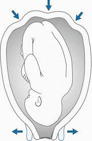 Bei der sogenannten eipollösung wird von der hebamme, der wann wird die geburt eingeleitet? Geburtseinleitung Springerlink