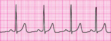 Acls Pre-Course Self-Assessment Flashcards | Quizlet