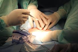 Cesarea Inflamada Trocando Fraldas
