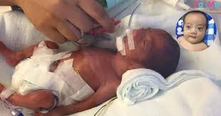 Dengan baby in pkpb ? Taksub Dengan Petua Nak Rawat Kuning Ibu Ini Menyesal Tak Sudah Selepas Usus Anak Luka Pa Ma