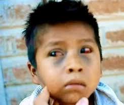 REFLEXIÓN.. Perdón mami... Erick: ya llegaste del colegio?, dijo su madre,  "Mami perdóname" y por qué quieres que te perdone estúpido, respondió su  madre. "Mami me perdonas?" ... Ahora qué hiciste en