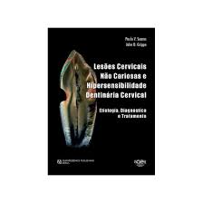 Paulo vinícius soares by franco santos on vimeo, the home for high quality videos and the people who love them. Livro Lesoes Cervicais Nao Cariosas E Hipersensibilidade Dentinaria Cervical Etiologia Diagnostico E Tratamento Soares Santos Comprar Na Livraria Florence