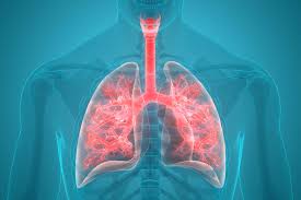 What Causes Lung Pain In The Back Roswell Park Comprehensive Cancer Center