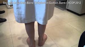 We did not find results for: Secuelas Pies De Guillain Barre Youtube