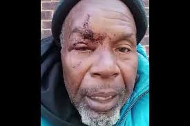 Fundraiser by Bad Future : Chester Stone Needs Your Help