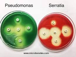Mueller hinton 2 agar + 5% sheep blood 90 mm (mhs) Microbiology Notes And Updates Pseudomonas And Serratia On Mueller Hinton Agar Mha Photo By Anupama Gurung From Kathmandu Nepal Facebook