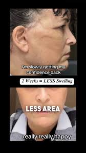 Centre For Facial Cosmetic & Plastic Surgery