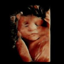 Ginecóloga Iris Bojórquez