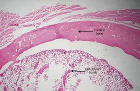 They are obtained by taking imaginary slices perpendicular to the main axis of organs, vessels, nerves, bones, soft tissue. Description