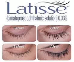 Pulled out eyelashes accident what to do. What Is Best Solution For Eyelashes Growth Quora