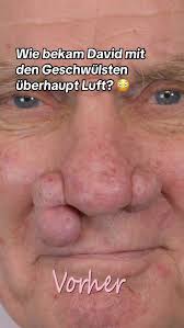 David's Transformation