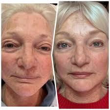 Monix Clinical Skincare