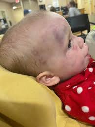 Falkville man indicted for 'striking' baby, family seeks justice