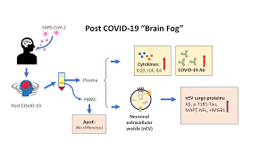 Work from home comes with its perks but many companies and people are itching to get back to the office. Cells Free Full Text Characterization And Biomarker Analyses Of Post Covid 19 Complications And Neurological Manifestations