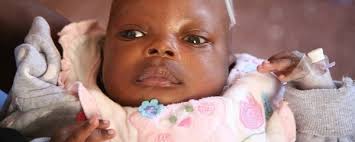 Brandon from Kenya raised $805 for spina bifida closure surgery.