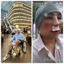 6 Potret Caren Delano Jalan-Jalan di Korea Usai Operasi, Wajah Masih  Diperban