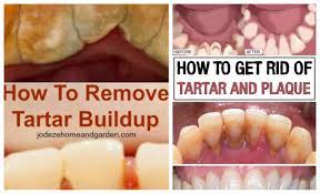 Let the juice stand on your teeth for about 5 minutes to soften the buildup, then rinse your mouth with baking soda and warm water for a bright, shiny smile. Natural Ways To Get Rid Of Tartar And Plaques That We All Must Try All For Fashion Design