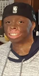 Tre' Smith's Journey to Recovery