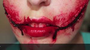 A glasgow smile (also known as a glasgow grin, anna grin, chelsea grin or chelsea smile) is a nickname for the result of cutting a victim's face sometimes further to hurt or even kill the victim, he or she would then be stabbed or kicked, most notably in the stomach (or in case of kicking, the groin). The Glasgow Smile The Scare Chamber