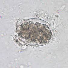 Hookworm Microscopy Findings