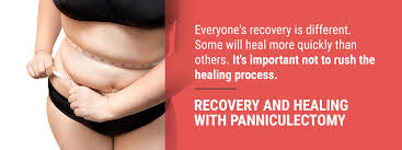 A panniculectomy, which will only remove excess skin, is also a very common surgery people undergo after extreme weight loss. Excess Skin Fat Removal Surgery Panniculectomy Sprsi