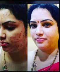 List of nearest Dietitians For Children in Kurukshetra Sector 13,  Kurukshetra