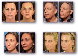 Plastic Surgeon Los Angeles Beverly Hills Medical Spa Rejuva Medical Aesthetics Medical Aesthetic Medical Spa Plastic Surgeon