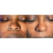 GoodLyfe Laser Medspa