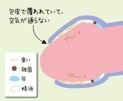 子宮頸がんの原因｢HPV｣とは? 包茎男性は女性に感染させやすいの? | 【包茎手術商法に騙されるな!】元仮性包茎が教える失敗しない病院の選び方